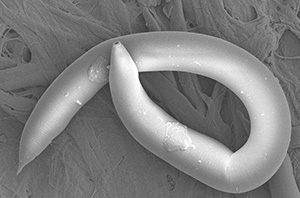 A nematode worm as seen under an ultra-microscope.